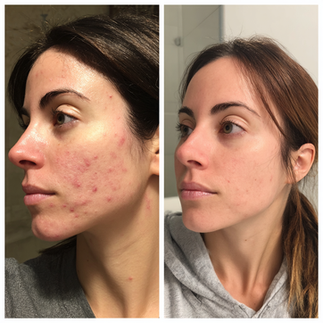 u4395736536_create_a_beforeafter_picture_split_down_the_middl_58f4a130-41be-40ec-990f-b80fc1a68a4d_2.png__PID:06981429-be07-4559-b48c-9d849788857b